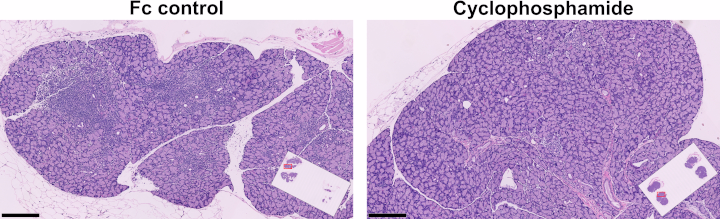 Lacrimal gland hematoxylin and eosin staining illustrative images